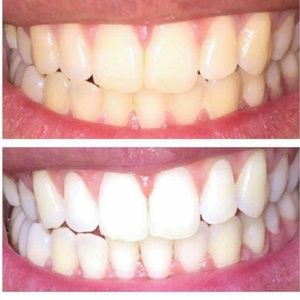 Whitening toothpaste